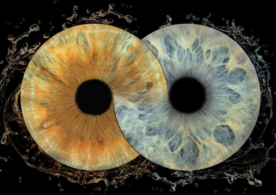 IRIS Photography (macro photo of your eye) - What happens during the 10-minute appointment